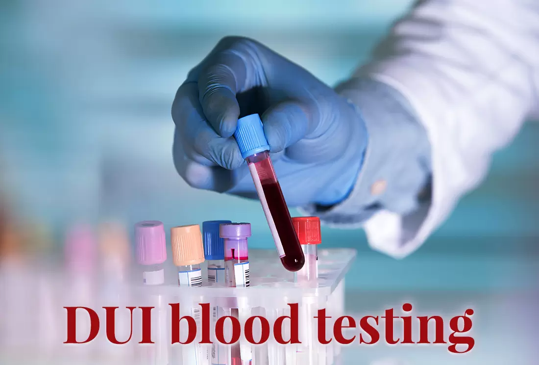 DUI Blood Test: What You Should Know about Chemical Testing